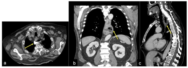 Figure 24