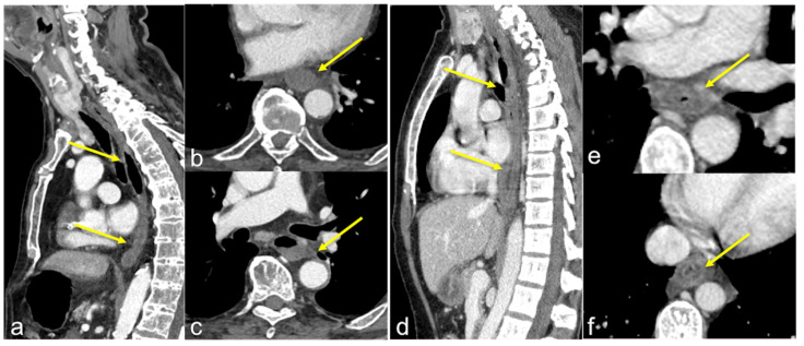 Figure 23