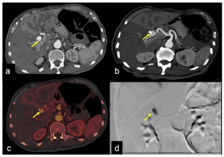 Figure 32