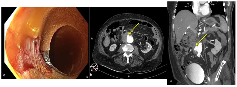 Figure 28