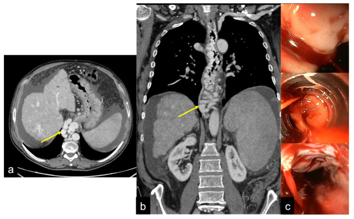 Figure 21