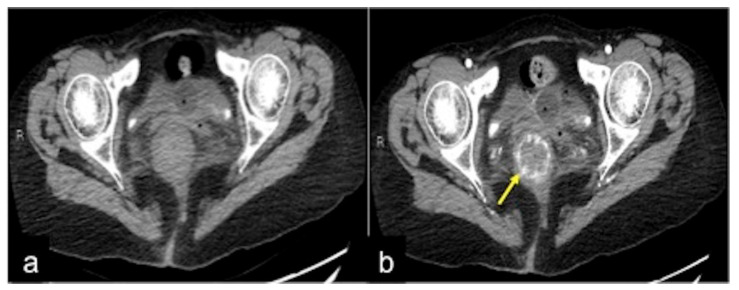 Figure 42