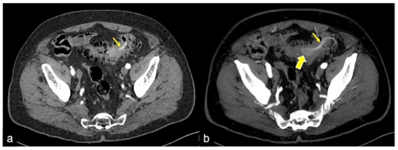 Figure 36