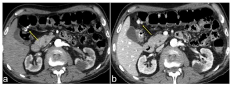 Figure 33