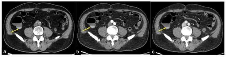 Figure 16