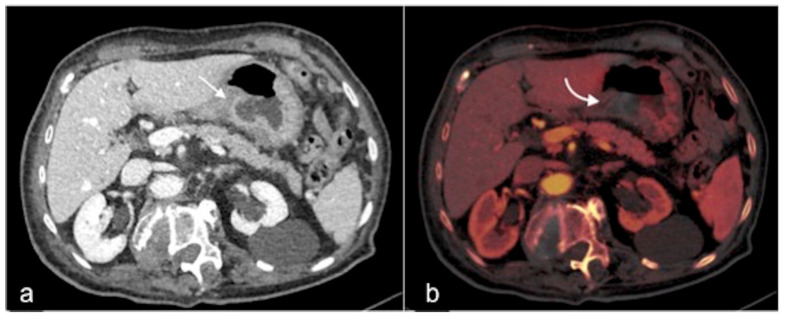 Figure 25