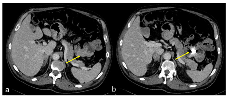 Figure 29