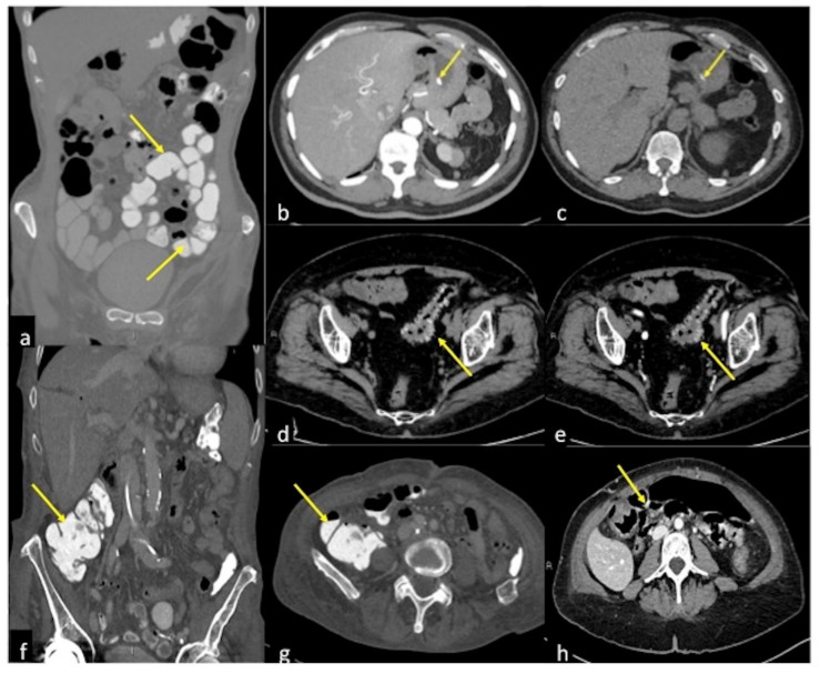 Figure 19