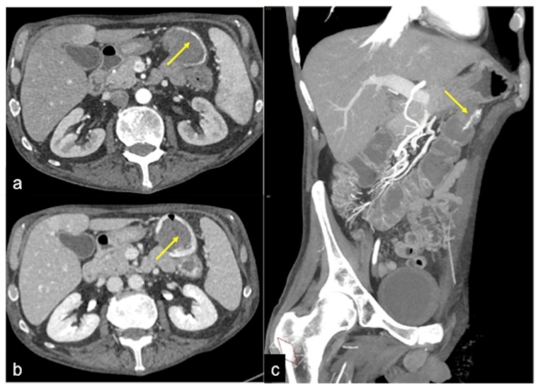 Figure 13