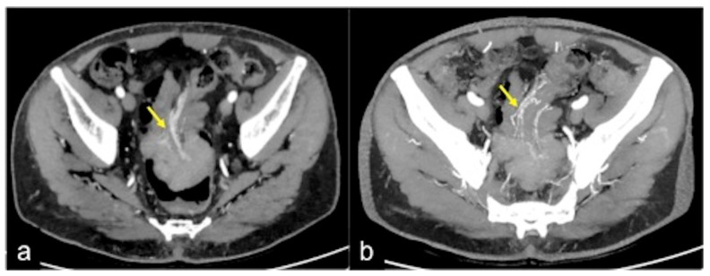 Figure 38