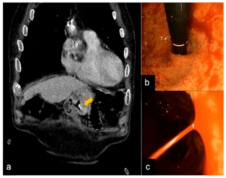 Figure 27