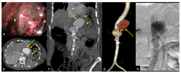 Figure 31