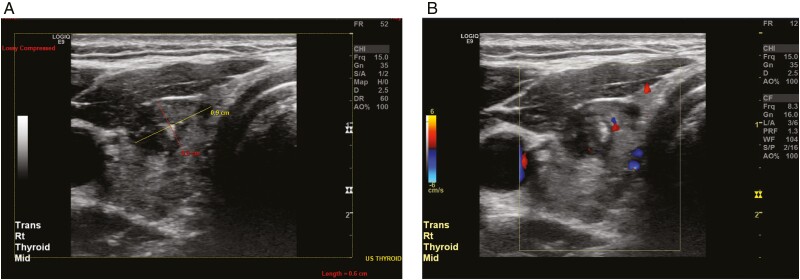 Figure 6.