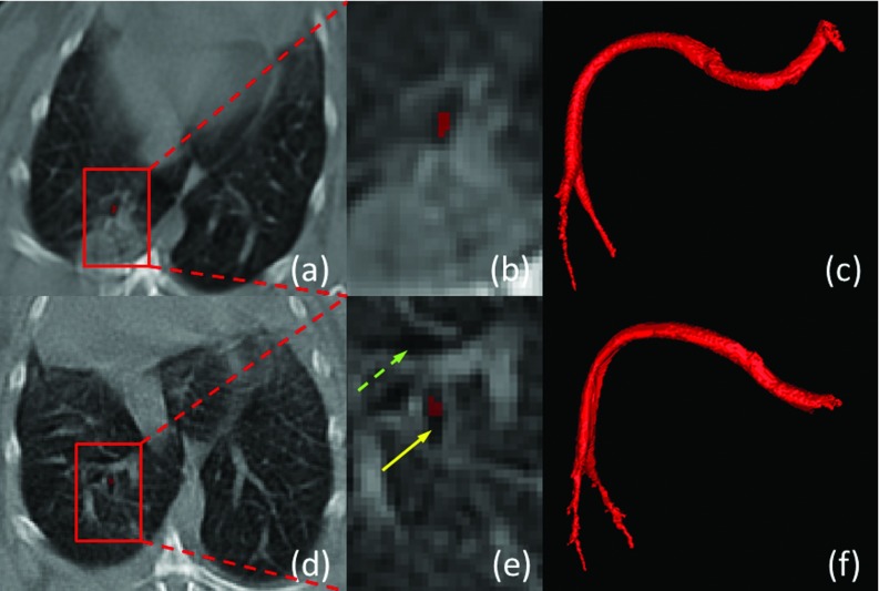 Figure 18