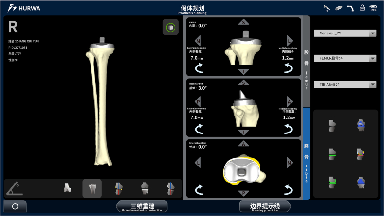 Figure 3