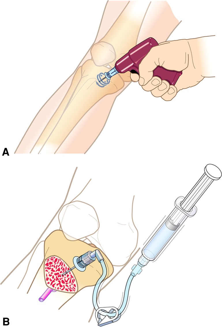 Fig. 1A–B