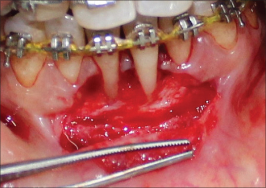 Figure 13