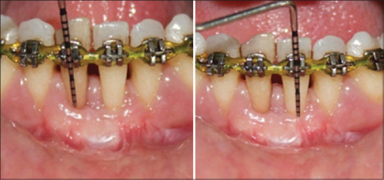 Figure 16
