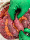 Fig. 3