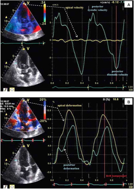 Fig. (1)