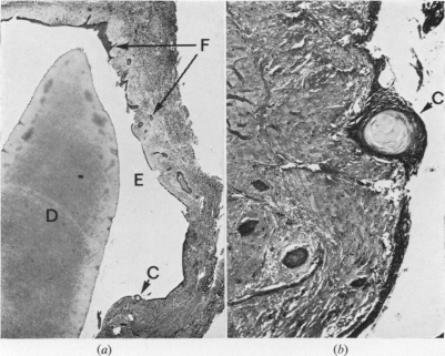 Fig. 10