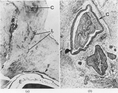 Fig. 12