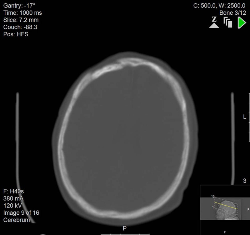 Figure 2