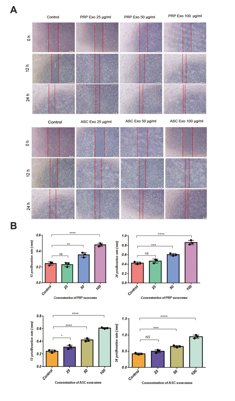 Fig.4