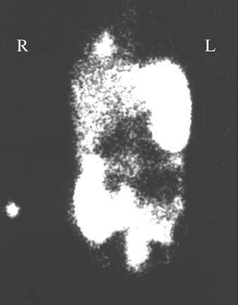 Fig. 64.5
