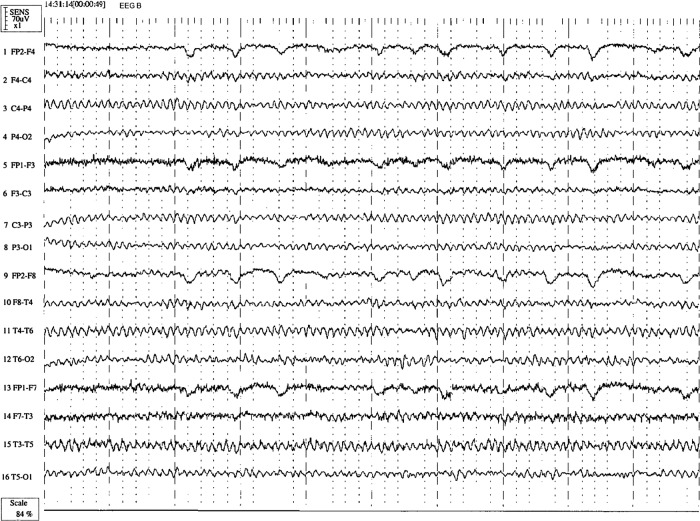 Figure 2