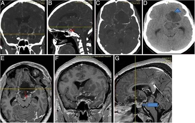 FIG. 3