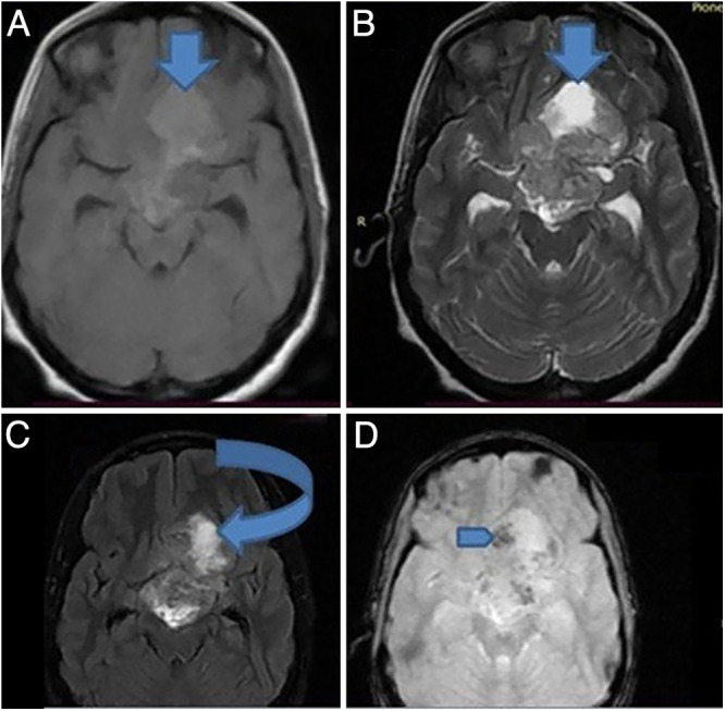 FIG. 1