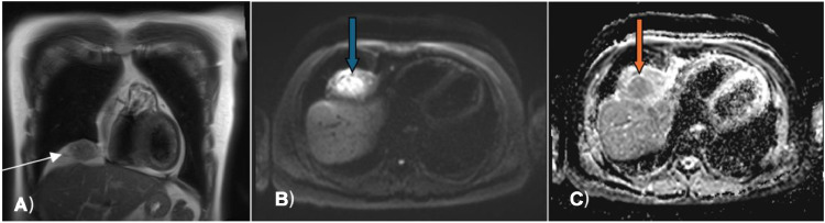 Fig 2: