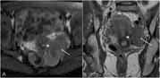Fig. 15