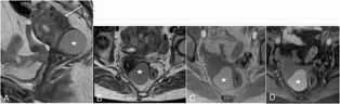 Fig. 18