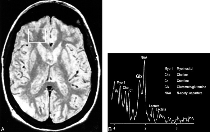 fig 18.