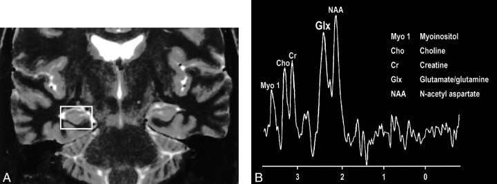 fig 17.