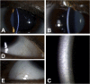 Fig. 2