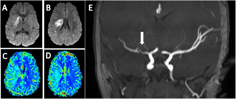 Fig. 1