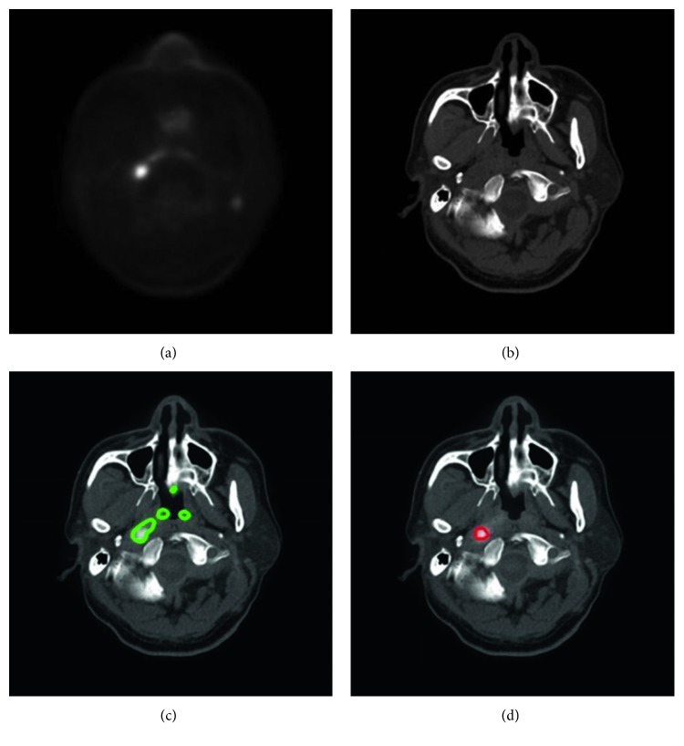 Figure 4