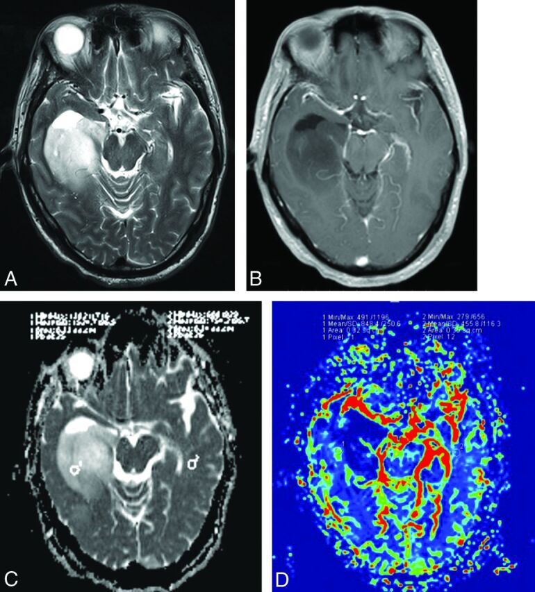 Fig 2.