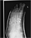 Fig. 5