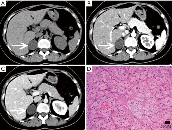 Figure 23