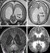 FIGURE 4–6