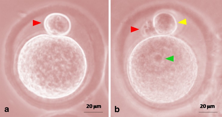 Fig. 5