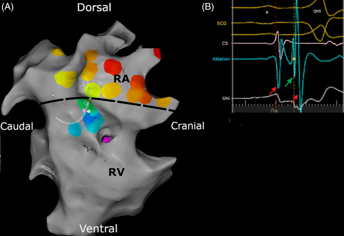 FIGURE 3