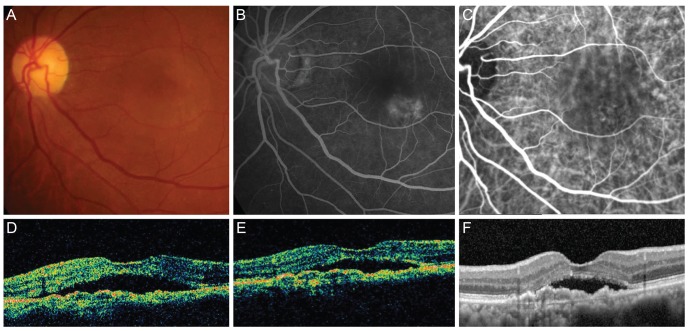 Fig. 2