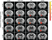 Figure 1—figure supplement 3.