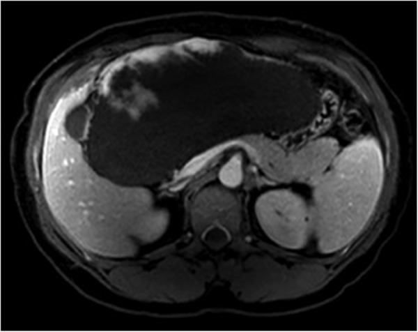 Figure 2