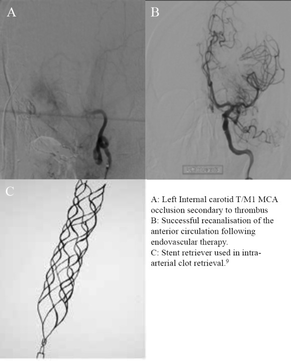 Fig 2.